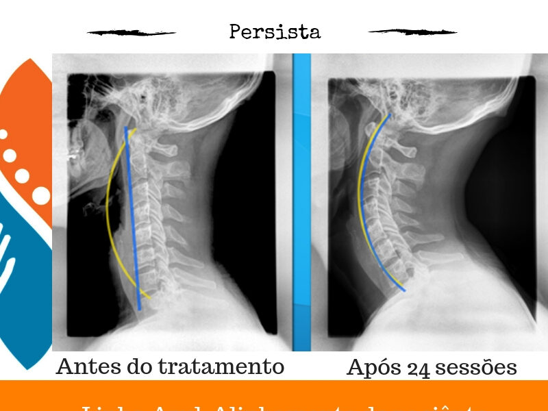 Quiropraxia São Paulo, Laserterapia, Liberação miofascial, Medicina Chinesa, Estudo do Sangue Vivo, Diagnóstico de Saúde.